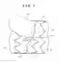 Fig. 08 - Stent