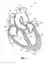 Fig. 02 - Catheter deliverable artificial multi-leaflet heart valve prosthesis and intravascular delivery system for a catheter deliverable heart valve prosthesis