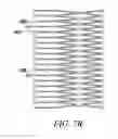 Fig. 08 - Mounting tool for loading a prosthesis