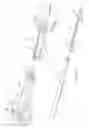 Fig. 12 - Mounting tool for loading a prosthesis