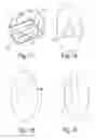 Fig. 09 - Allogenic Articular Cavity Prosthesis and Method for Implanting the Same