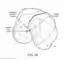 Fig. 49 - Patient-adapted and improved orthopedic implants, designs and related tools