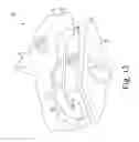 Fig. 12 - Semi-constrained ankle prosthesis having a rotating bearing insert