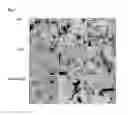 Fig. 09 - Mutant alpha-synuclein, and methods using same