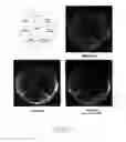 Fig. 07 - Specific genetic modification of the activity of trehalose-6-phosphate synthase and expression in a homologous or heterologous environment