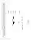 Fig. 15 - Specific genetic modification of the activity of trehalose-6-phosphate synthase and expression in a homologous or heterologous environment