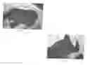 Fig. 07 - Wrist protecting glove and methods thereof