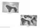 Fig. 08 - Wrist protecting glove and methods thereof