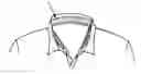 Fig. 01 - Collar guard and hat guard