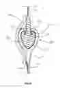 Fig. 07 - Slidable permanent fastener
