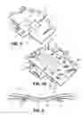 Fig. 04 - Patient positioning device