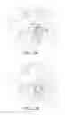 Fig. 09 - Needle plate and sewing machine