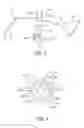 Fig. 04 - Sacrocolpopexy support and method of implantation