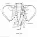Fig. 32 - Sacrocolpopexy support and method of implantation