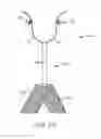 Fig. 35 - Sacrocolpopexy support and method of implantation