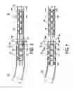 Fig. 04 - Electrical jumper for a producing oil well