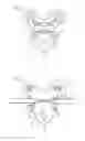 Fig. 03 - Safety line traveller