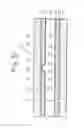 Fig. 40 - LIQUID CRYSTAL DISPLAY APPARATUS HAVING ALIGNMENT CONTROL FOR BRIGHTNESS AND RESPONSE