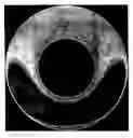 Fig. 01 - METHOD OF MAKING A SOFT CONTACT LENS