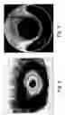 Fig. 03 - METHOD OF MAKING A SOFT CONTACT LENS