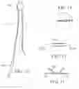 Fig. 13 - Solder and lead free electronic circuit and method of manufacturing same