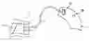 Fig. 01 - System, method and hearing aids for in situ occlusion effect measurement