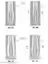 Fig. 13 - Specific absorption rate measurement and energy-delivery device characterization using thermal phantom and image analysis