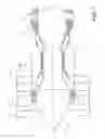 Fig. 02 - Component and a gas turbine engine comprising the component