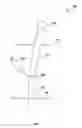 Fig. 02 - SYSTEM AND METHOD FOR PLUGGING A BROKEN FLUID DELIVERY PIPE