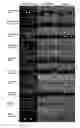 Fig. 01 - Vaccine compositions compromising βs-crystallin for inducing immune responses against components of drusen