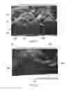Fig. 05 - Three dimensional structures useful as cleaning sheets