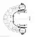 Fig. 06 - Device for fixing orthodontic devices