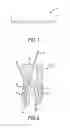Fig. 02 - Apparatus and method for root canal obturation