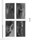 Fig. 62 - Multi-Level Competition/Game, Talent, and Award Show Productions Systems, Methods and Apparatus