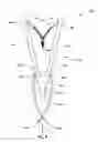 Fig. 06 - Systems and methods for sling delivery and placement