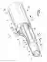 Fig. 02 - Dialysis catheter