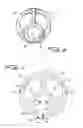 Fig. 04 - Dialysis catheter