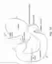 Fig. 02 - Gastrointestinal anchor compliance