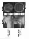 Fig. 07 - Biomaterials for tissue replacement