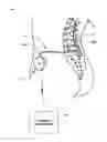 Fig. 01 - Implantable medical pump with pressure sensor