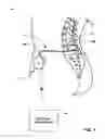 Fig. 02 - Implantable medical pump with pressure sensor