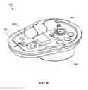 Fig. 08 - Implantable medical pump with pressure sensor
