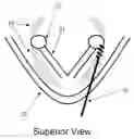 Fig. 01 - Methods and devices for arytenoid repositioning