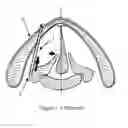Fig. 02 - Methods and devices for arytenoid repositioning