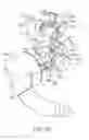 Fig. 09 - Tissue resecting system