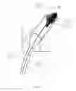 Fig. 06 - Systems and methods for removing and fragmenting undesirable material within a circulatory system