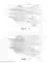 Fig. 08 - Systems and methods for removing and fragmenting undesirable material within a circulatory system
