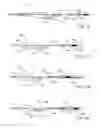 Fig. 07 - Systems and methods for vascular filter retrieval