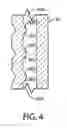 Fig. 06 - Self-locking closure device for percutaneously sealing punctures