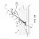 Fig. 09 - Apparatus and methods for sealing a puncture in tissue